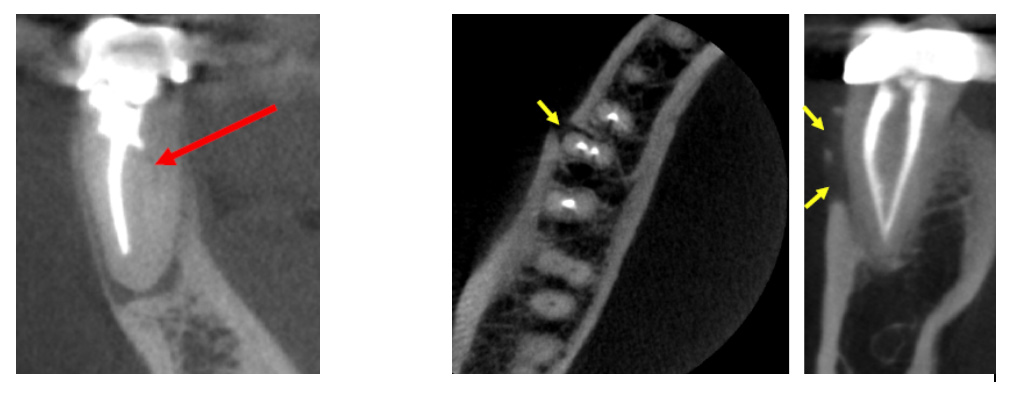 Endodontist in Lubbock